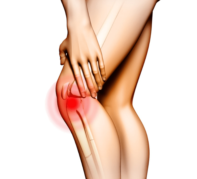 Stages of osteoarthritis