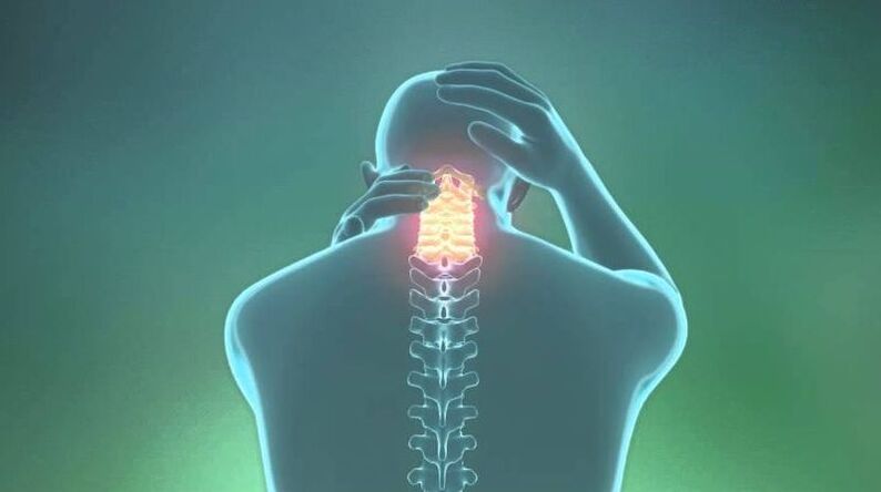 Osteochondrosis of the cervical region