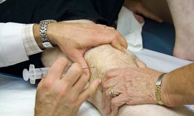 How to distinguish arthrosis arthritis